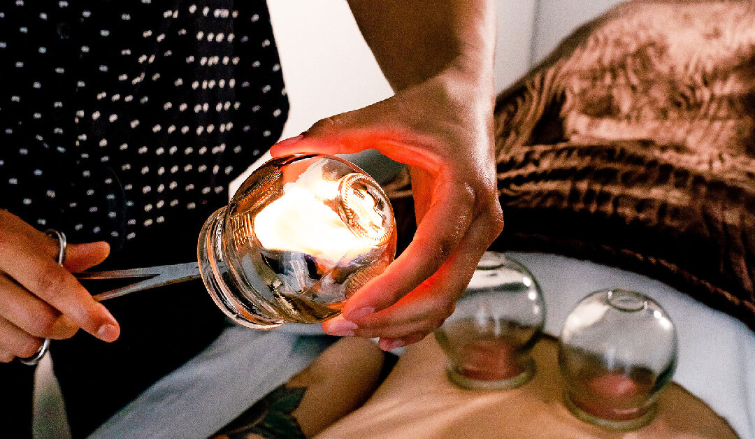 Cupping